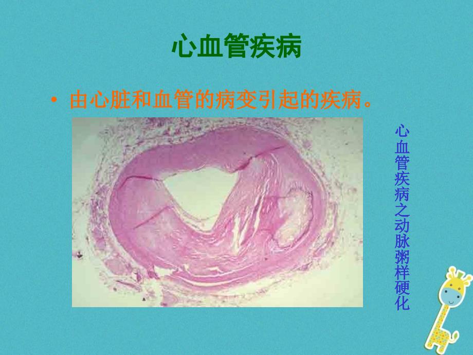 辽宁省法库县八年级生物下册 第二十五章 第二节 威胁健康的主要疾病课件 （新版）苏教版_第3页