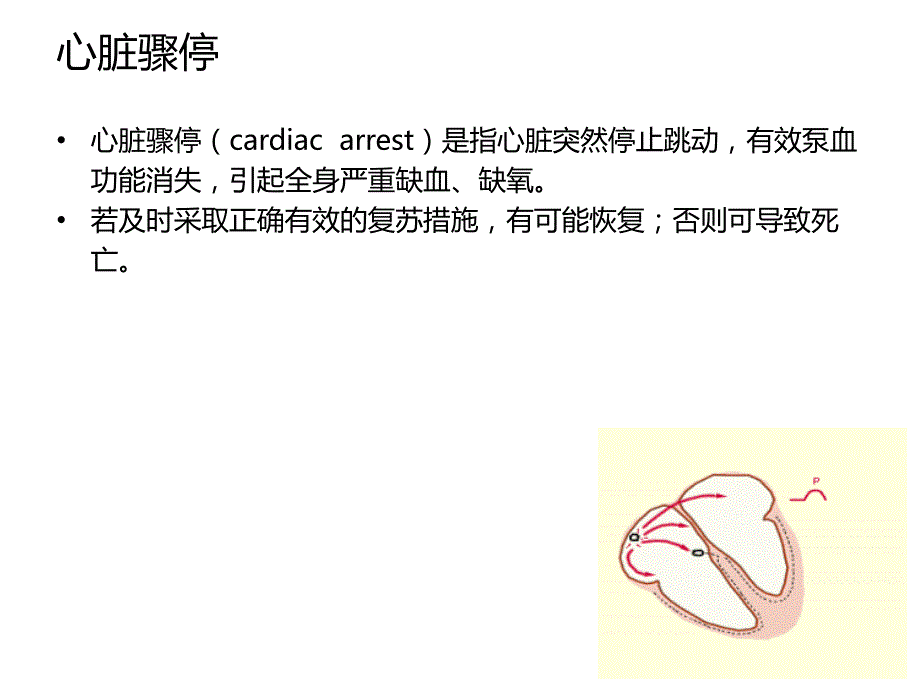 cpr复苏新概念 心肺脑复苏_第4页