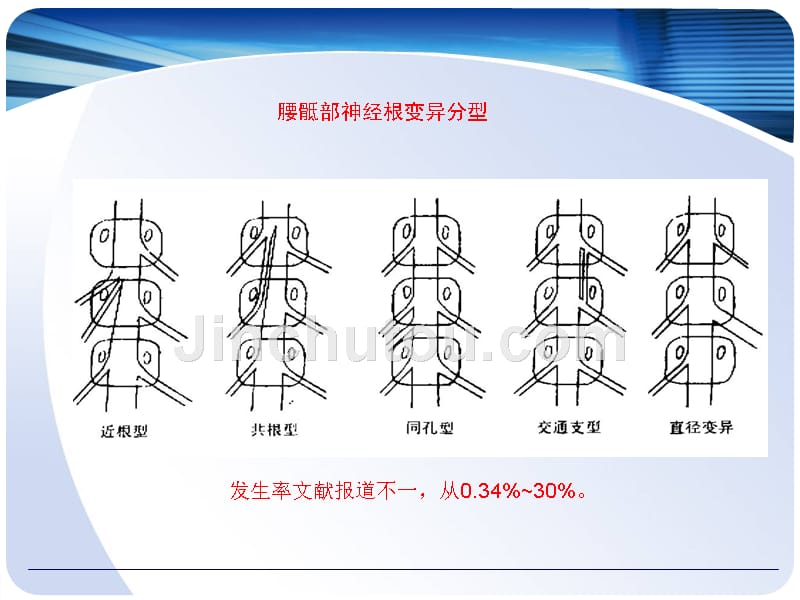 侧路椎间孔镜治疗L5S1椎间盘突出的经验分享_第4页