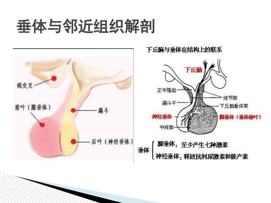 垂体瘤影像诊断_第3页