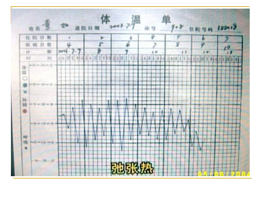 呼吸系统疾病小儿肺炎ppt课件_第2页