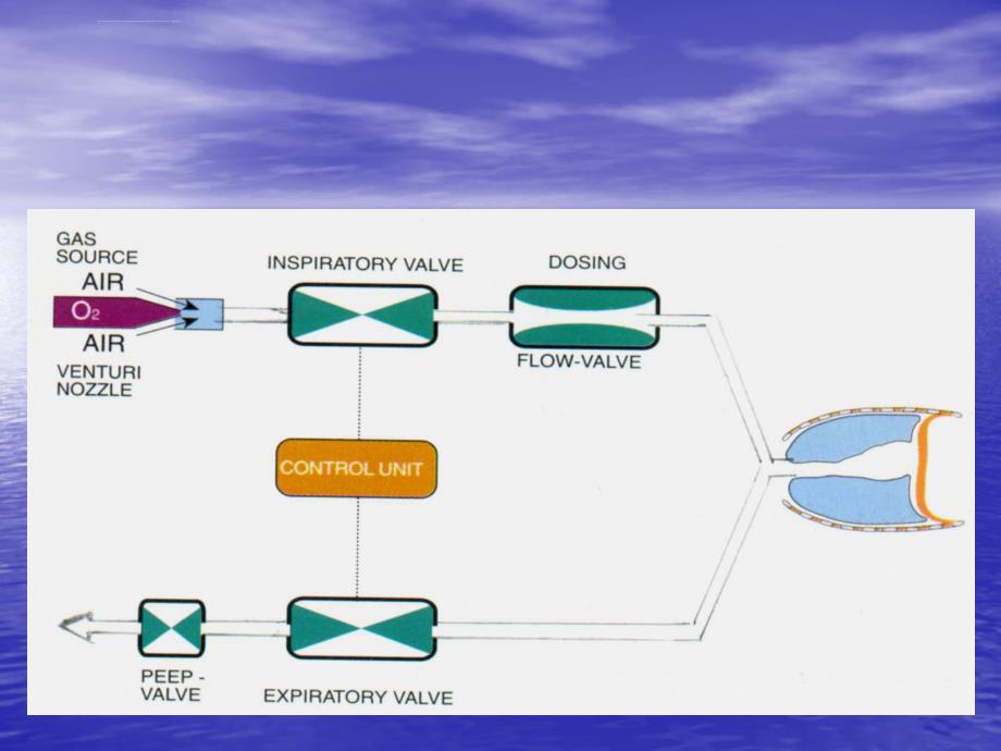 呼吸机的临床应用ppt课件_第4页