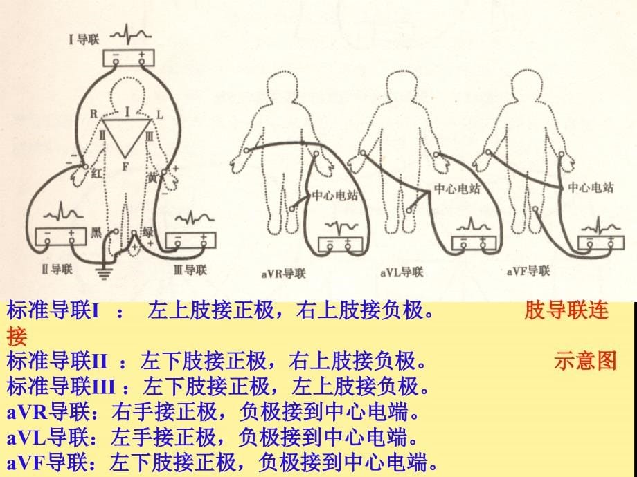 常见心电图基础知识_第5页