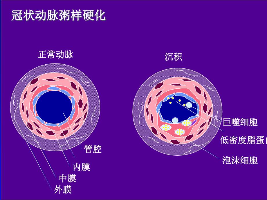 冠心病规范化治疗ppt课件_第4页