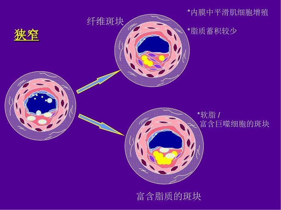 冠心病规范化治疗ppt课件_第5页