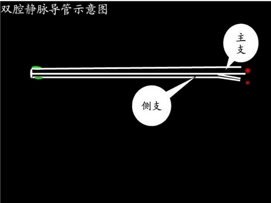 中心静脉置管护理（3）课件_第5页