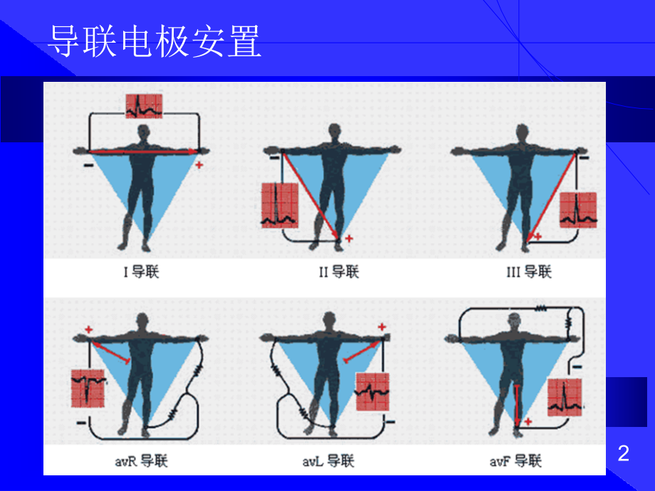 心电图的阅读方法09923ppt课件_第3页