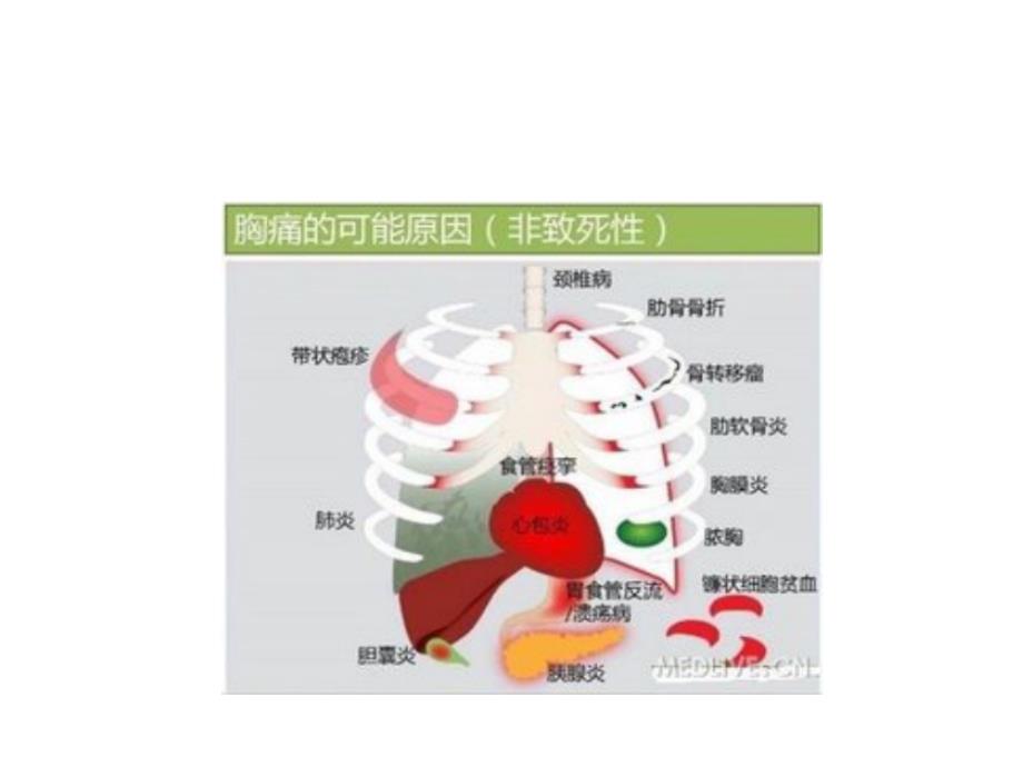 诊断学胸腹头痛ppt课件_第4页