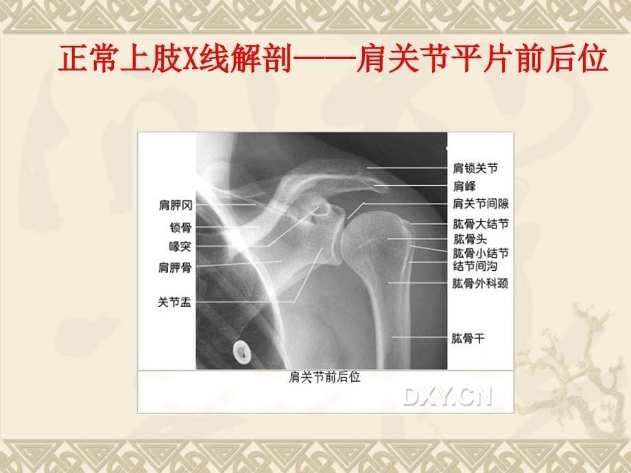 正常解剖x线影像学课件_第5页