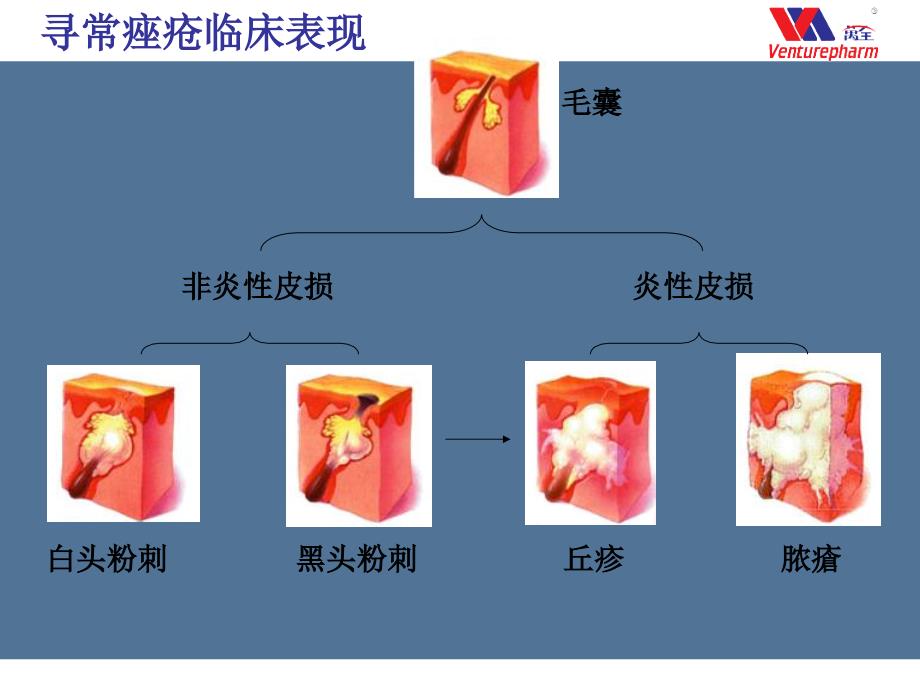 阿达帕林凝胶万全达文_第4页