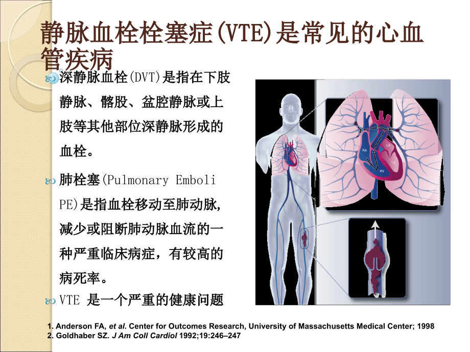 医学ppt静脉血栓栓塞的介入治疗_第4页