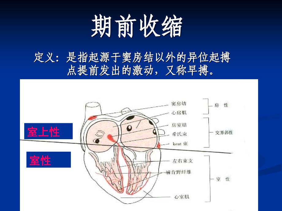 心律失常实验诊断ppt课件_第2页