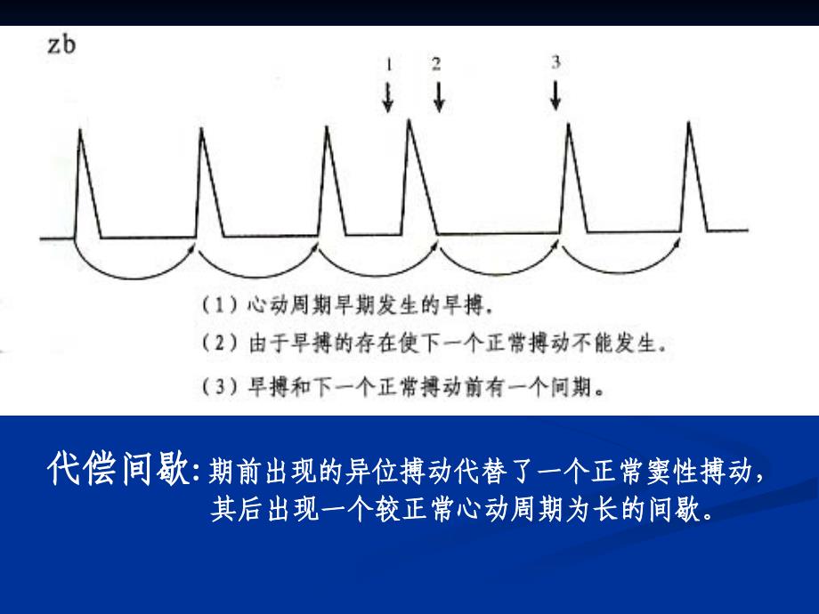 心律失常实验诊断ppt课件_第3页