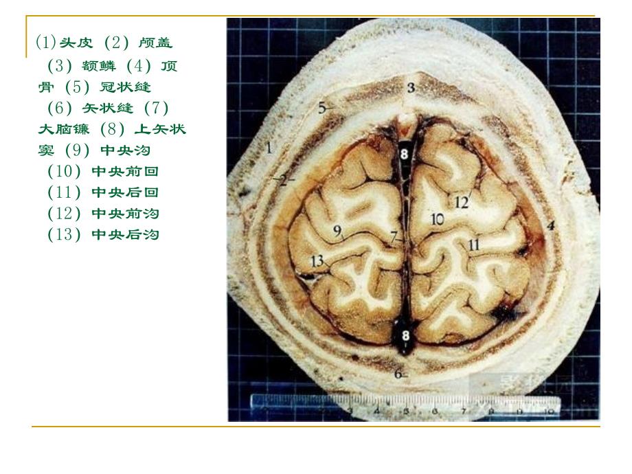 人体断层解剖图谱大脑_第4页