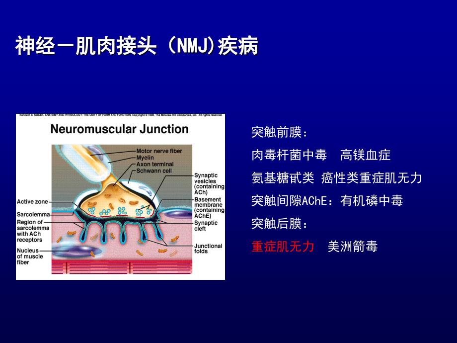 重症肌无力ppt课件_1_第3页