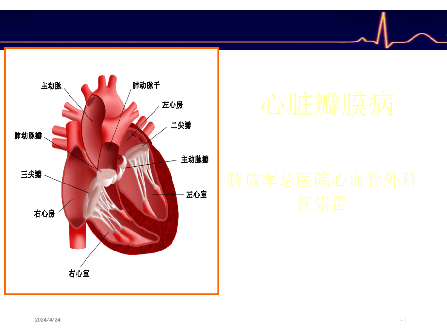 心脏瓣膜病教学课件_4_第1页