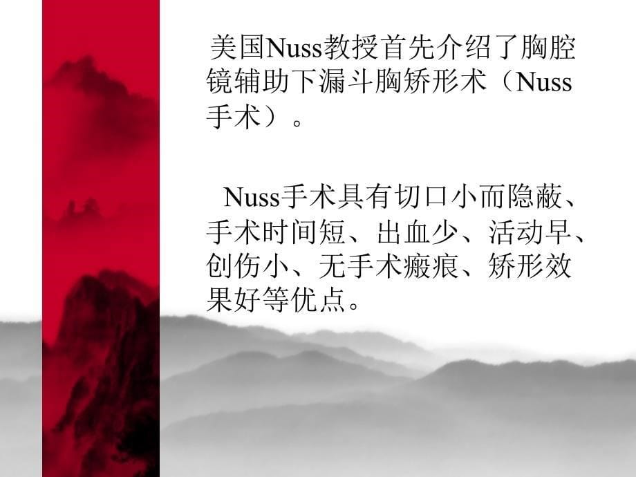 NUSS手术_第5页