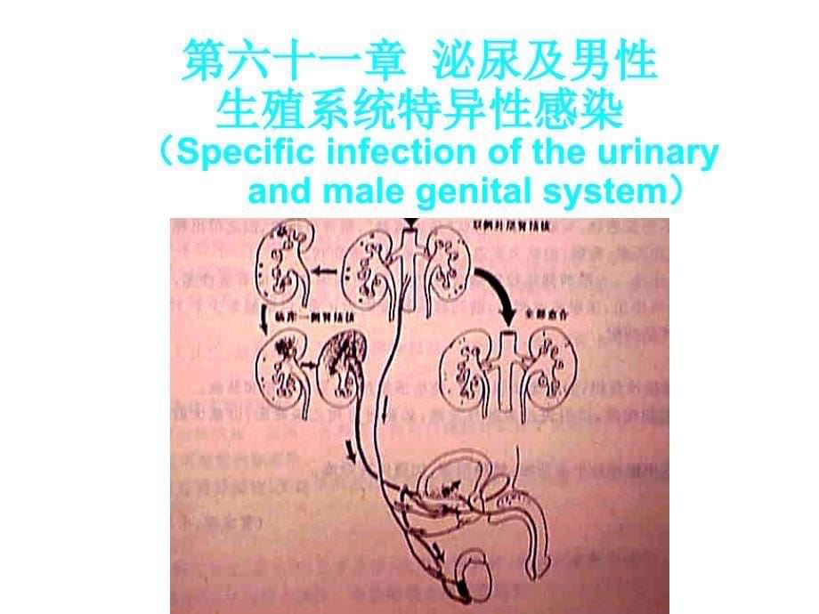 泌尿及男性生殖系感染(1)_第5页