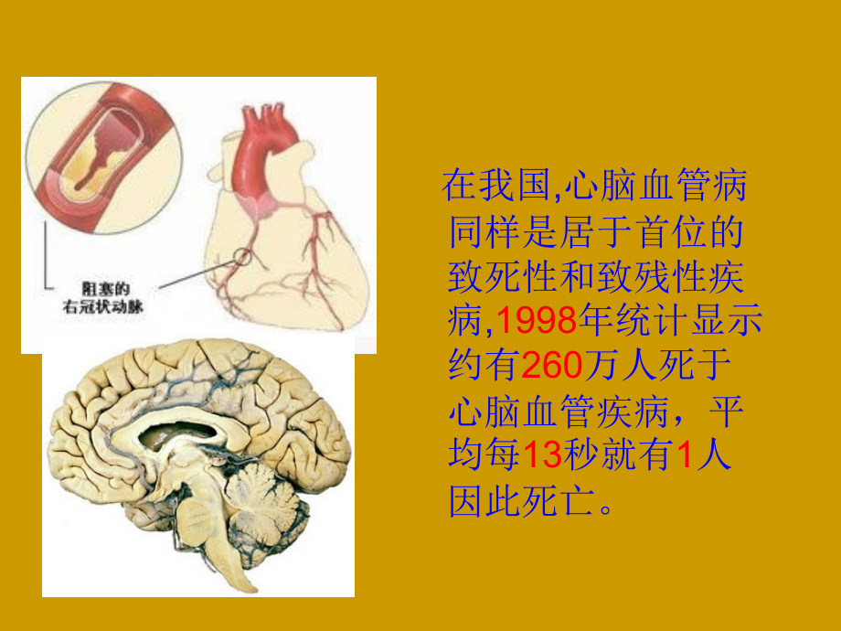 心血管疾病健康管理_第3页