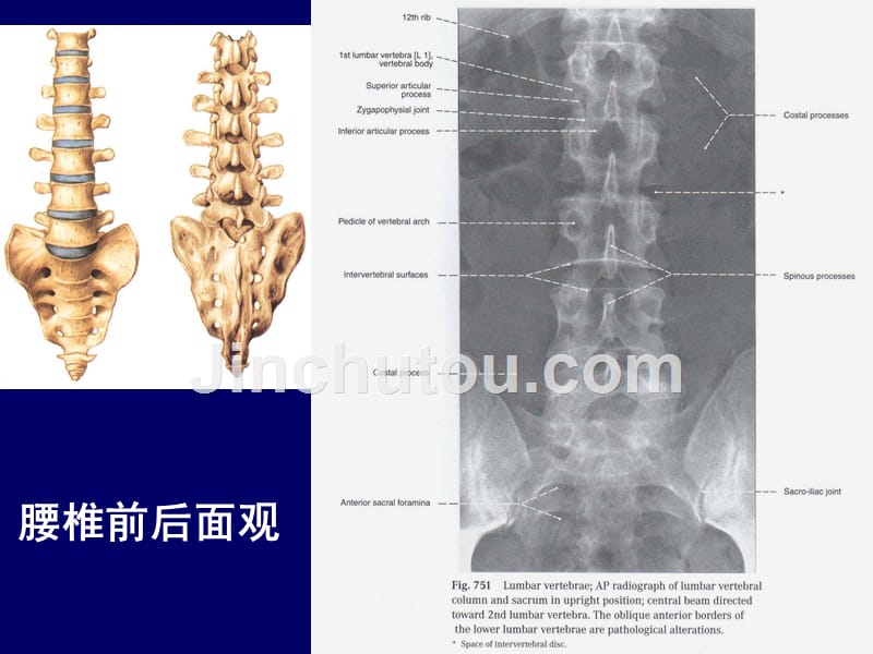 影像诊断脊柱区腰段断层解剖ppt课件_第4页