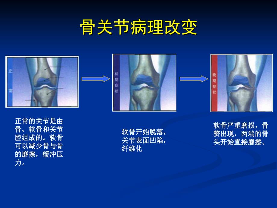 盐酸氨基葡萄糖ppt课件_第4页