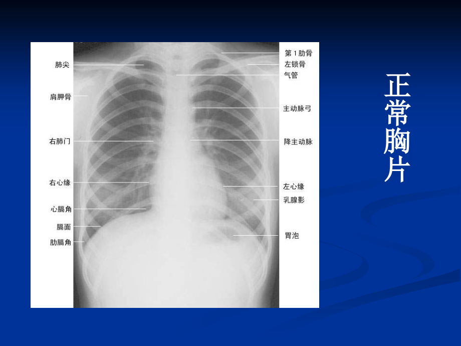 执业医师技能考试x线ppt课件_1_第2页