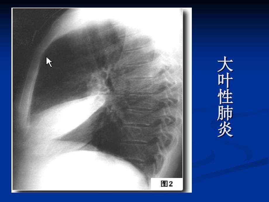 执业医师技能考试x线ppt课件_1_第5页