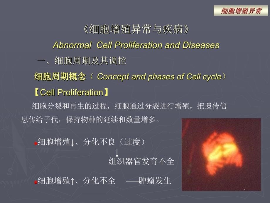 病理生理学8细胞增殖分化凋亡异常与疾病3_第5页