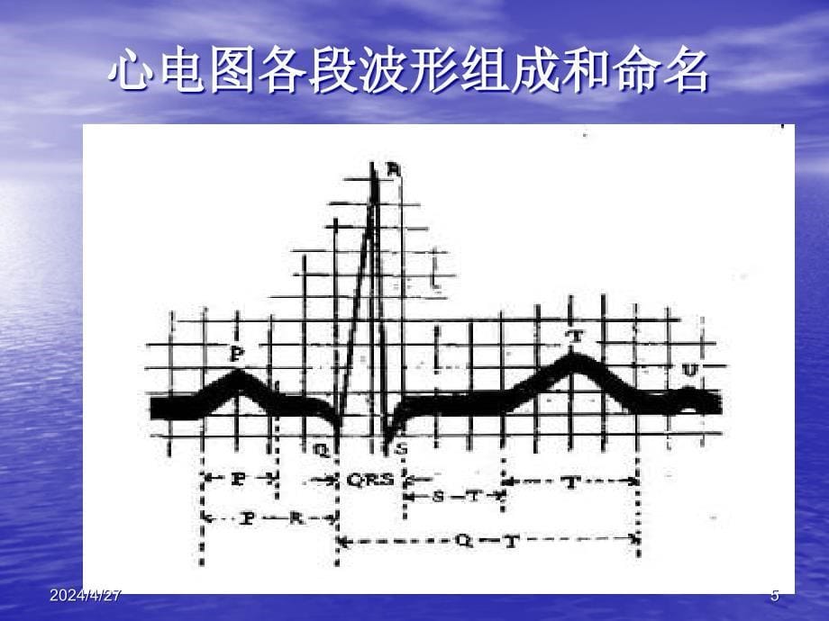 心电图课件16769幻灯片_第5页