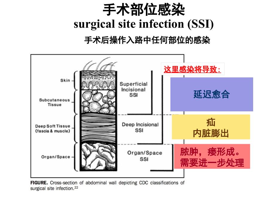 预防性抗菌素与外科部位感染控制46170ppt课件_第2页