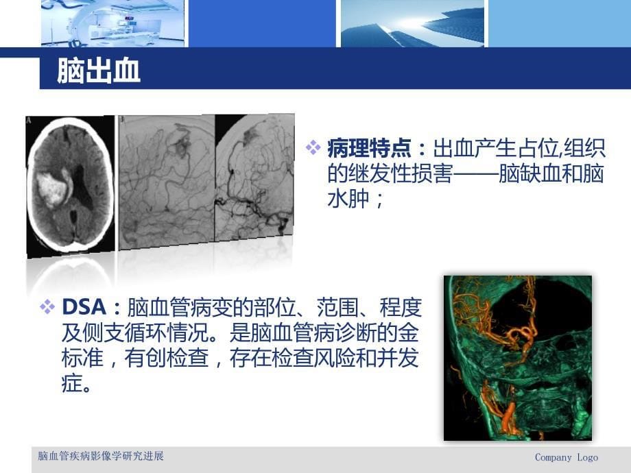 脑血管疾病影像学ppt课件_第5页