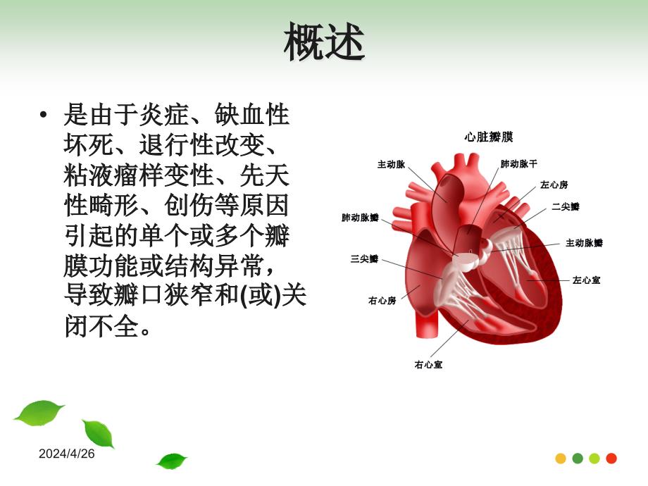 心脏瓣膜病（1） ppt课件_第3页