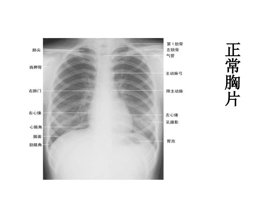 线临床执业医师实践技能考试图片精选 ppt课件_第1页