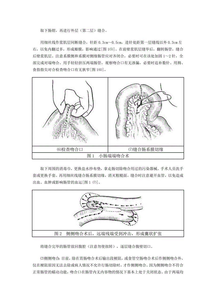 小肠切除吻合术_第4页