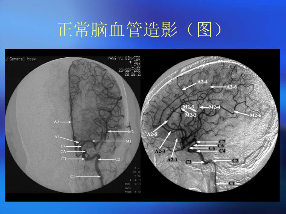 颅骨x线诊断_第2页