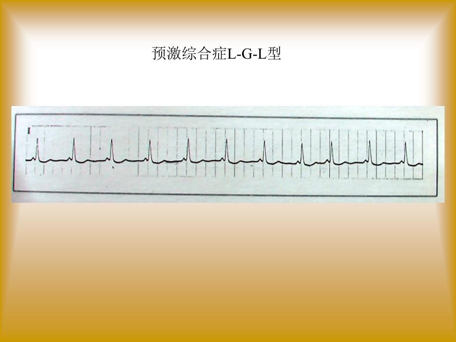 职业医师考试心电图及影像考试题答案_第1页