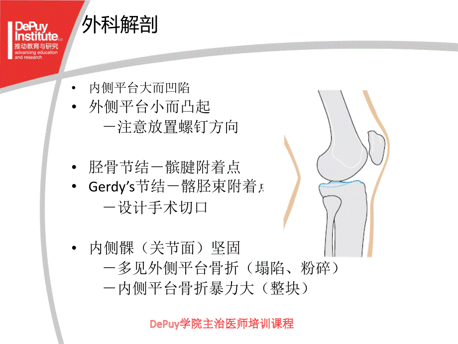 胫骨平台骨折depuy_第3页