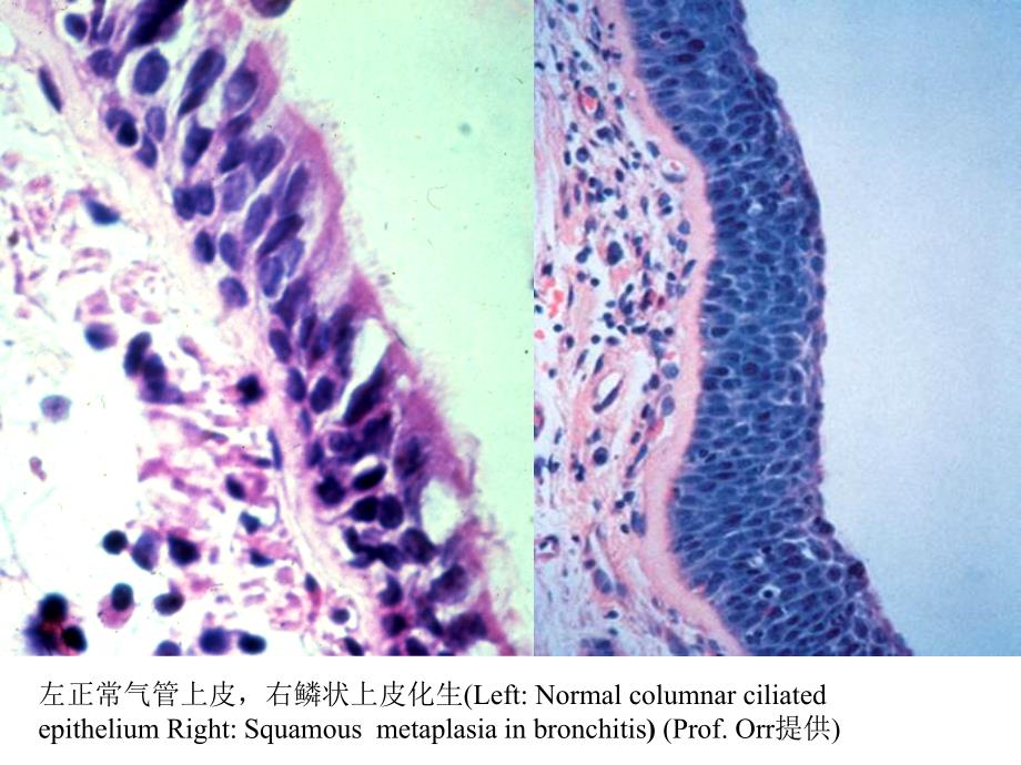 病理学实验教学组织切片示教图选_第3页