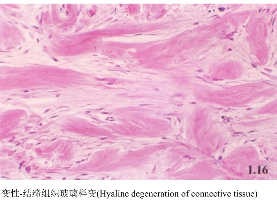 病理学实验教学组织切片示教图选_第4页