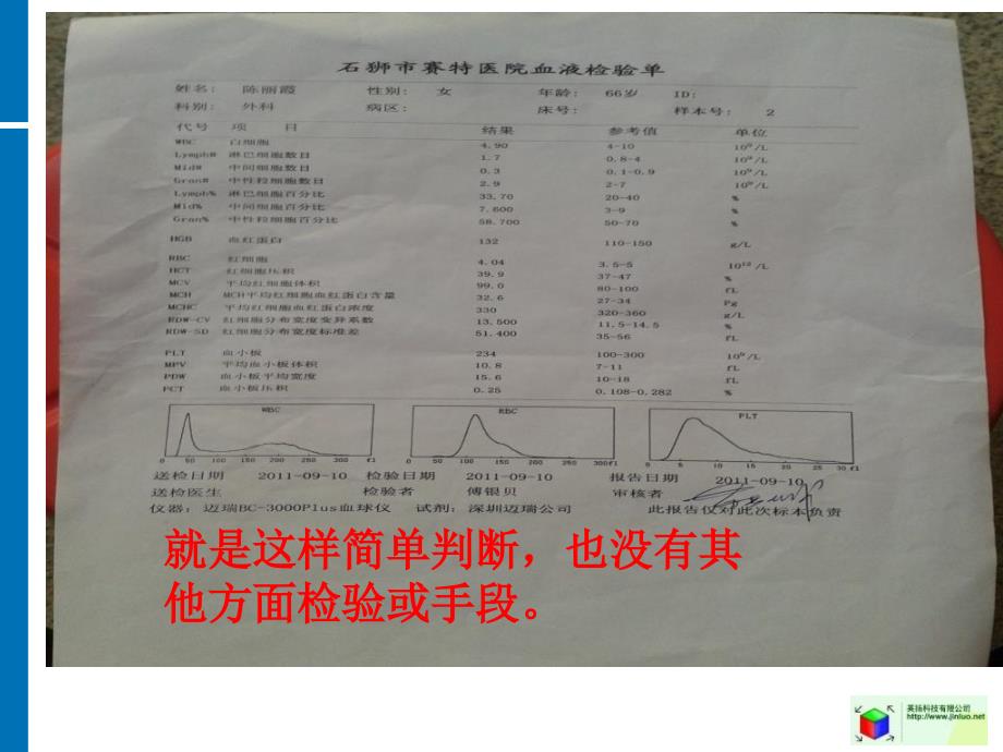 肺结核空洞与纤维化对躯体全面影响_第3页