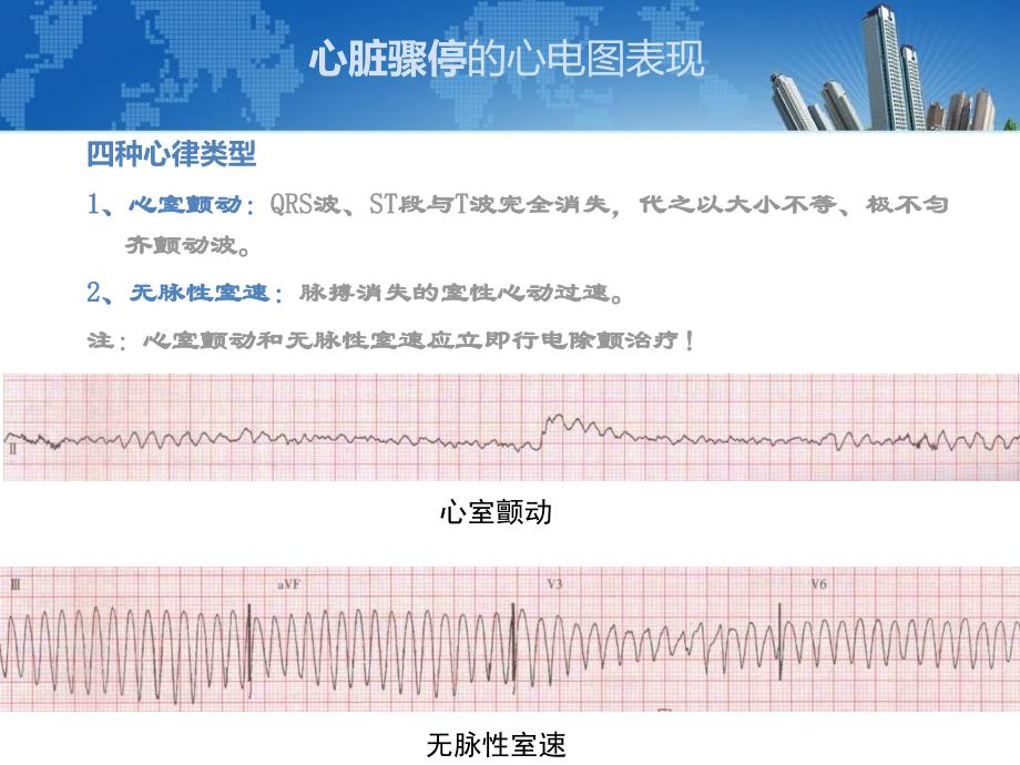 最新心肺复苏cpr指导_第4页