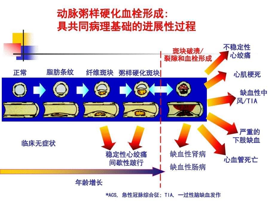 西药综合 第十章 冠状动脉粥样硬化性心脏病_第5页