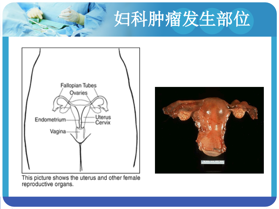 妇科恶性肿瘤2017_第2页
