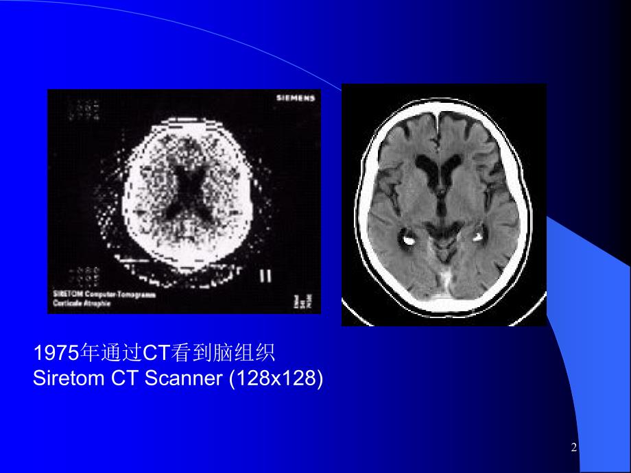CT介绍及其在颅脑疾病中的应用PPT课件_第2页