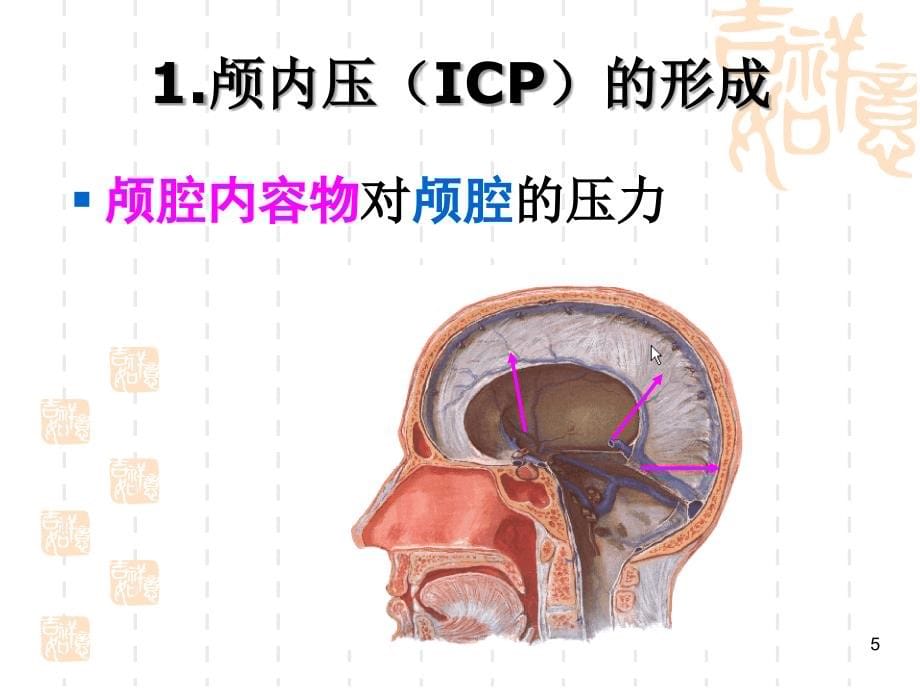 颅脑疾病病人的护理ppt课件_第5页