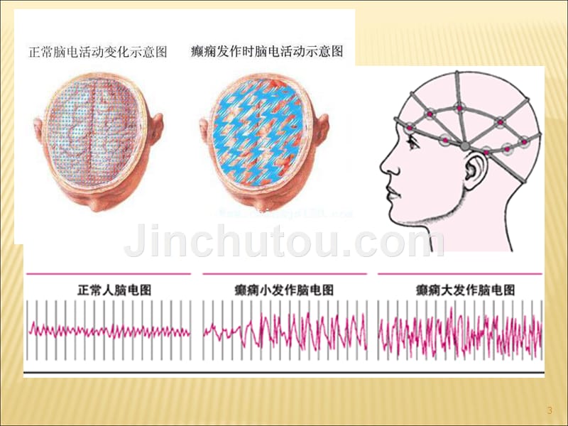 抗癫痫抗惊厥药PPT课件_第3页