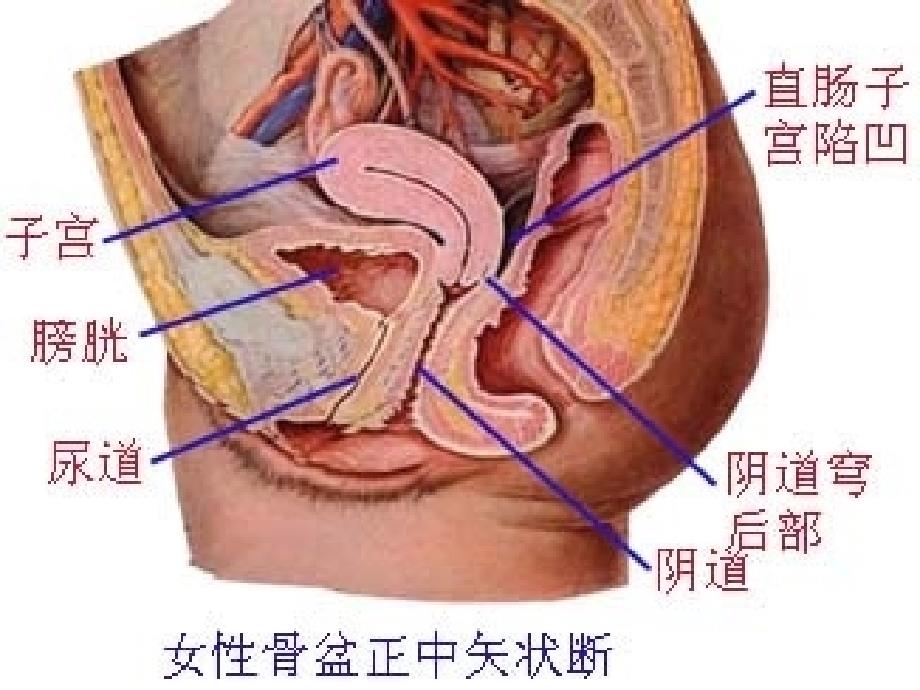 留置导尿的并发症及护理措施 ppt课件_第4页