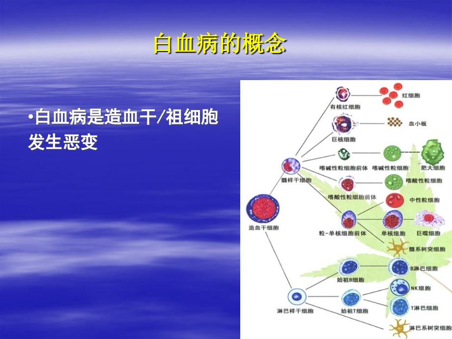 急性白血病诊断分型和预后_第2页