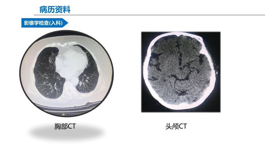 机械通气患者早期康复_第4页