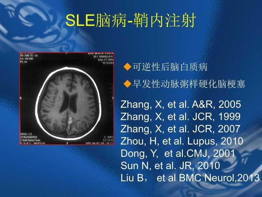 风湿病科研思路_第5页